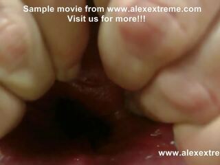 Alexextreme - 肛門 拳交, 燧, 脫垂, 極端 假陽具