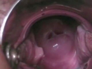 Cervikal orgasme en détail, gratuit hd cochon film vid 6f | xhamster
