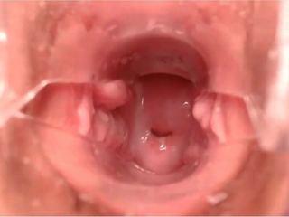 Ohmibod romig sperma speculum diep binnenin cervix: hd volwassen klem ba